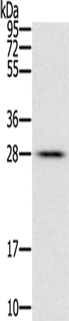 Rabbit Polyclonal Antibody to FAM89B