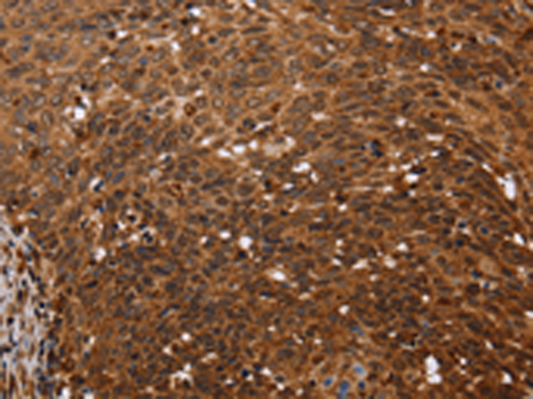 Rabbit Polyclonal Antibody to FANCF