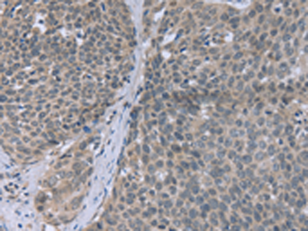 Rabbit Polyclonal Antibody to FANCG