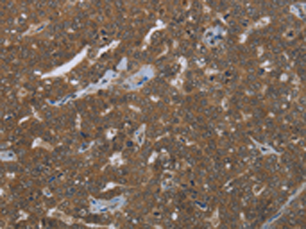 Rabbit Polyclonal Antibody to FASTKD1