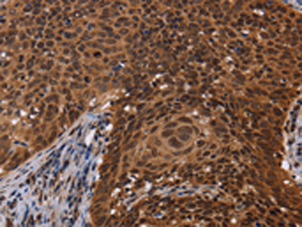 Rabbit Polyclonal Antibody to FASTKD5