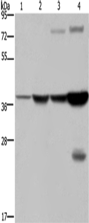 Rabbit Polyclonal Antibody to FBP1