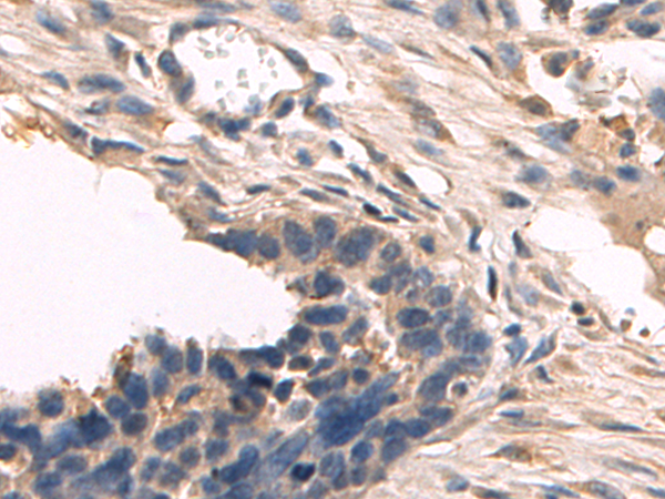 Rabbit Polyclonal Antibody to FBP2