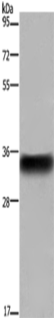 Rabbit Polyclonal Antibody to FCGR2B
