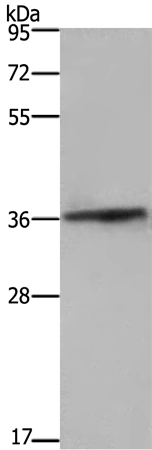 Rabbit Polyclonal Antibody to FCAR
