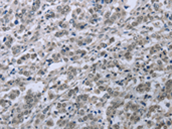 Rabbit Polyclonal Antibody to FES
