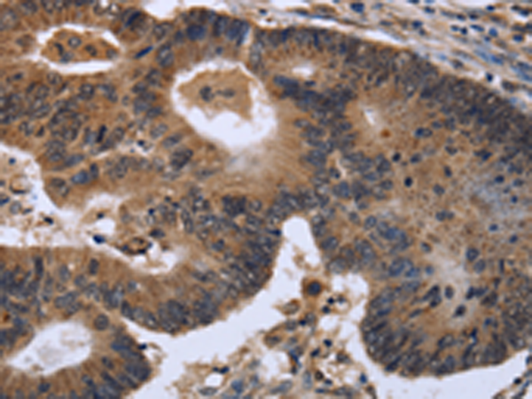 Rabbit Polyclonal Antibody to FGF21