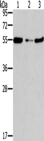 Rabbit Polyclonal Antibody to FGFR1OP