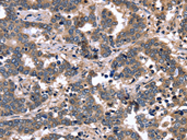 Rabbit Polyclonal Antibody to FGFR1OP2