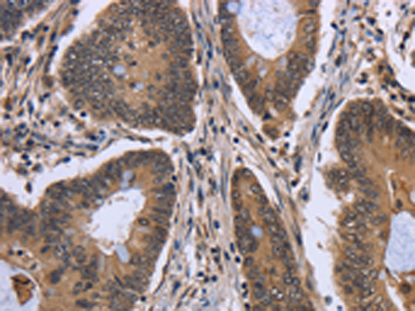 Rabbit Polyclonal Antibody to FGFRL1