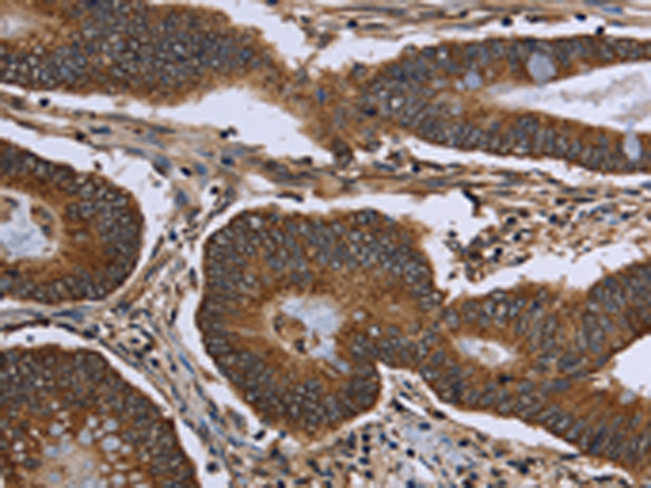 Rabbit Polyclonal Antibody to FHIT