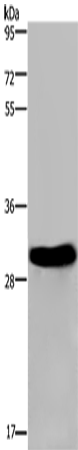 Rabbit Polyclonal Antibody to FHL2