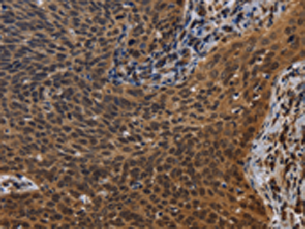 Rabbit Polyclonal Antibody to FHL3