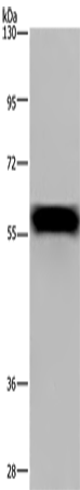 Rabbit Polyclonal Antibody to FGB