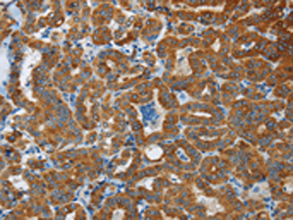 Rabbit Polyclonal Antibody to FLCN