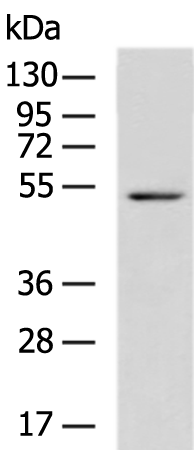 Rabbit Polyclonal Antibody to FLI1