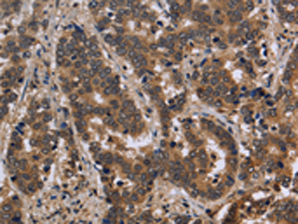 Rabbit Polyclonal Antibody to FMR1