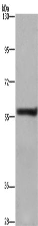 Rabbit Polyclonal Antibody to FRK