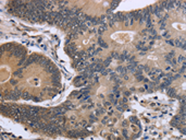 Rabbit Polyclonal Antibody to FSTL1