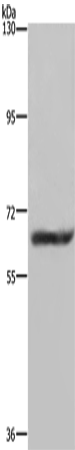 Rabbit Polyclonal Antibody to FTO