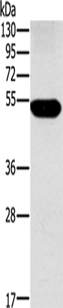 Rabbit Polyclonal Antibody to FUCA1