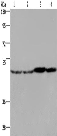 Rabbit Polyclonal Antibody to FH