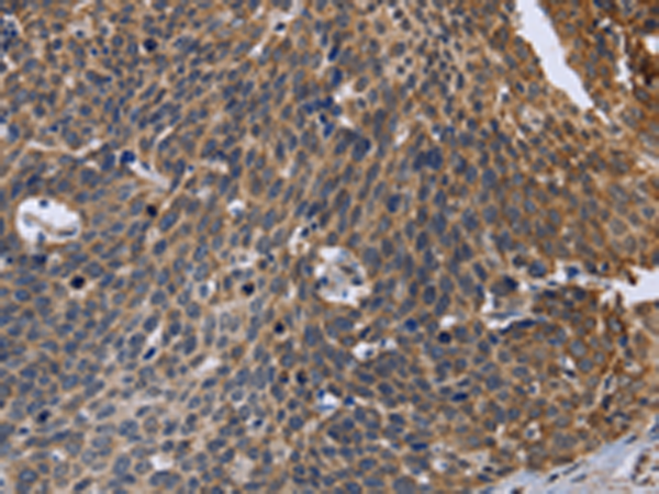 Rabbit Polyclonal Antibody to GABPB2