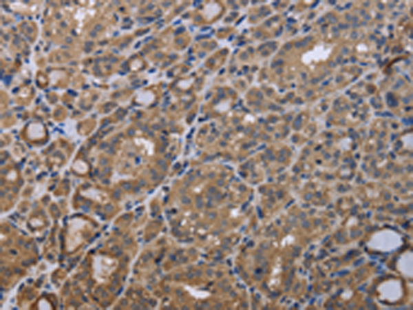 Rabbit Polyclonal Antibody to GADD45B