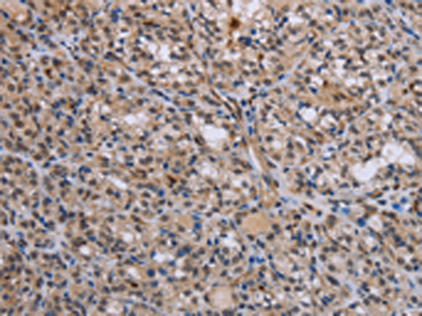 Rabbit Polyclonal Antibody to GADD45A