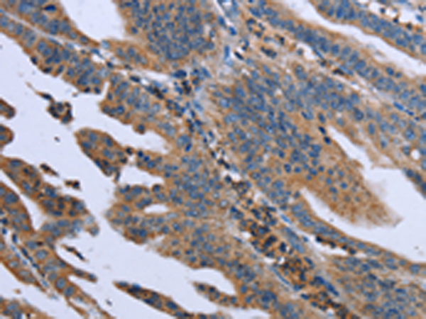 Rabbit Polyclonal Antibody to GNAI3