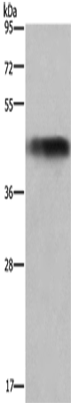 Rabbit Polyclonal Antibody to GALT