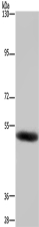 Rabbit Polyclonal Antibody to GABRB1