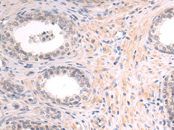 Rabbit Polyclonal Antibody to PIP
