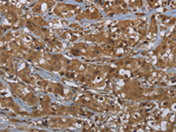 Rabbit Polyclonal Antibody to GCK