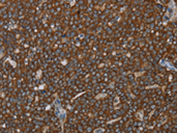 Rabbit Polyclonal Antibody to GCKR
