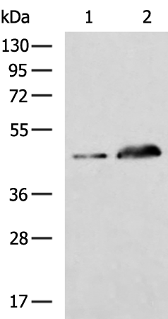 Rabbit Polyclonal Antibody to GCM1