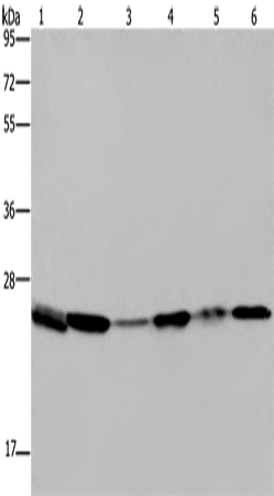 Rabbit Polyclonal Antibody to ARHGDIA