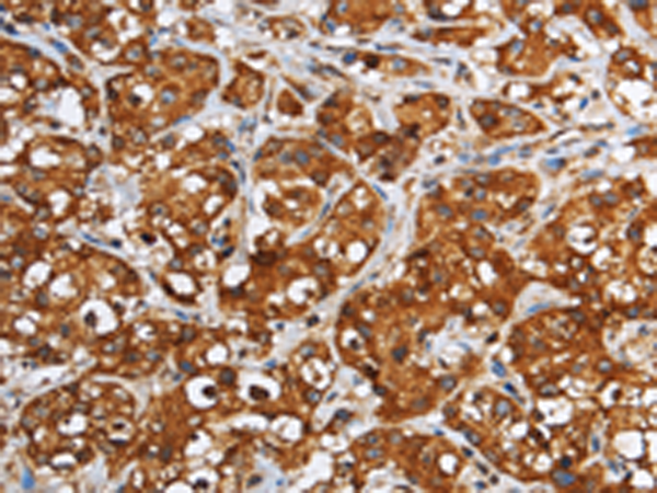 Rabbit Polyclonal Antibody to GGCX