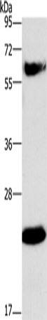 Rabbit Polyclonal Antibody to GGT1