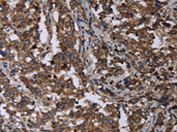 Rabbit Polyclonal Antibody to DNAJC15