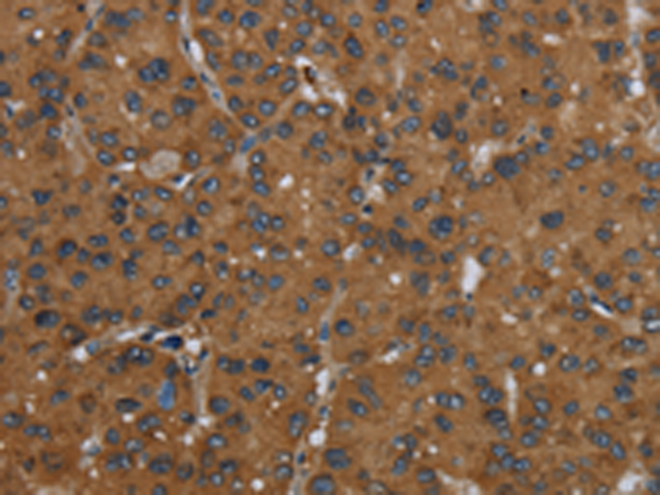 Rabbit Polyclonal Antibody to ID2