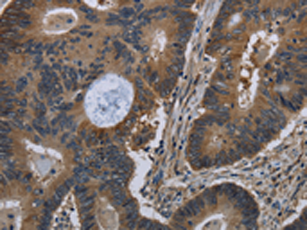 Rabbit Polyclonal Antibody to TSC22D3