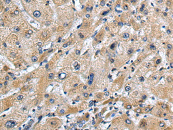 Rabbit Polyclonal Antibody to GLIPR1