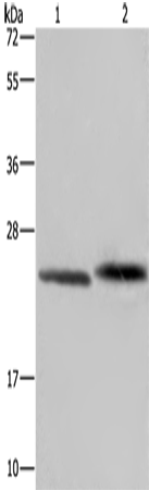 Rabbit Polyclonal Antibody to GLO1
