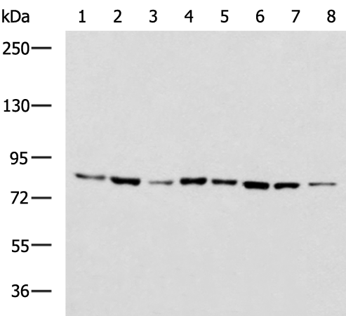 Rabbit Polyclonal Antibody to NR3C1