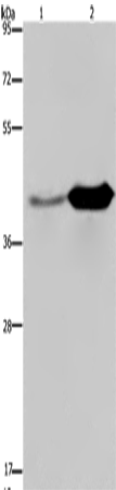 Rabbit Polyclonal Antibody to GLUL