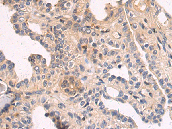 Rabbit Polyclonal Antibody to GLRX