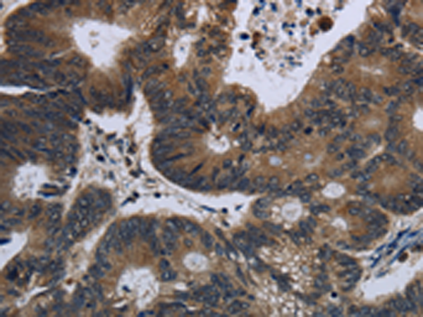Rabbit Polyclonal Antibody to GK