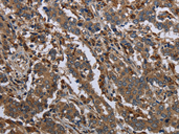 Rabbit Polyclonal Antibody to GYS2