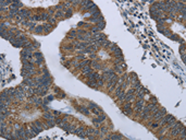 Rabbit Polyclonal Antibody to GYPC